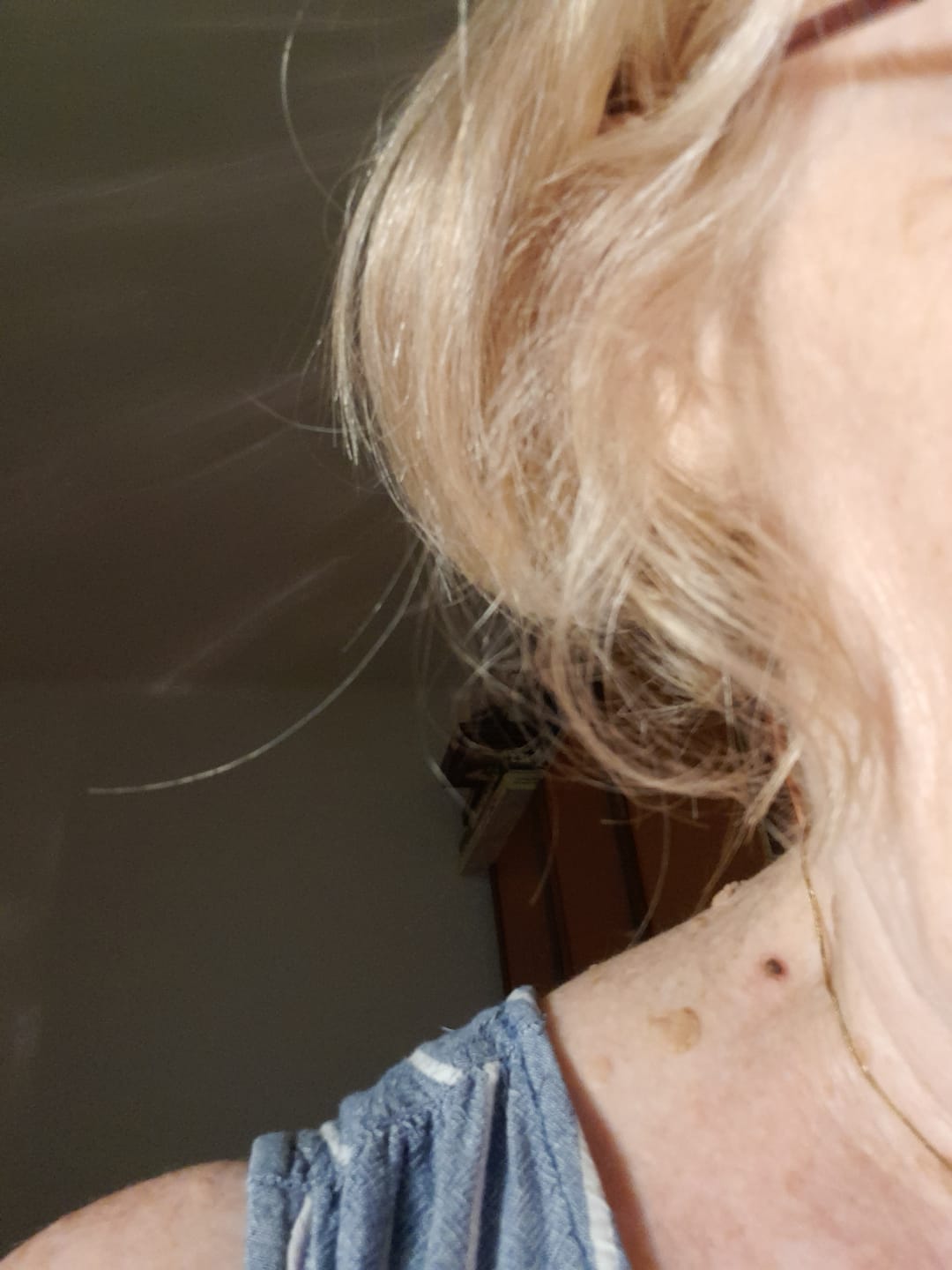Customer photo review of Hipoallergén Mikrogyűrűk (20db - vegyes)