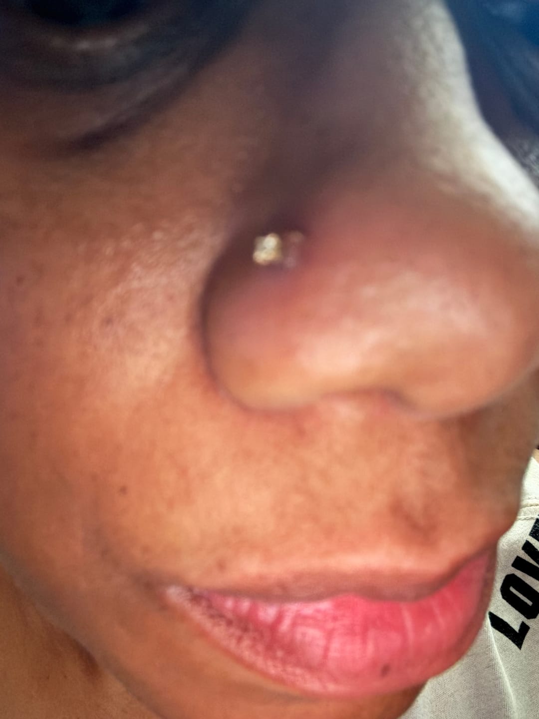 Customer photo review of Keloid Repair Duo