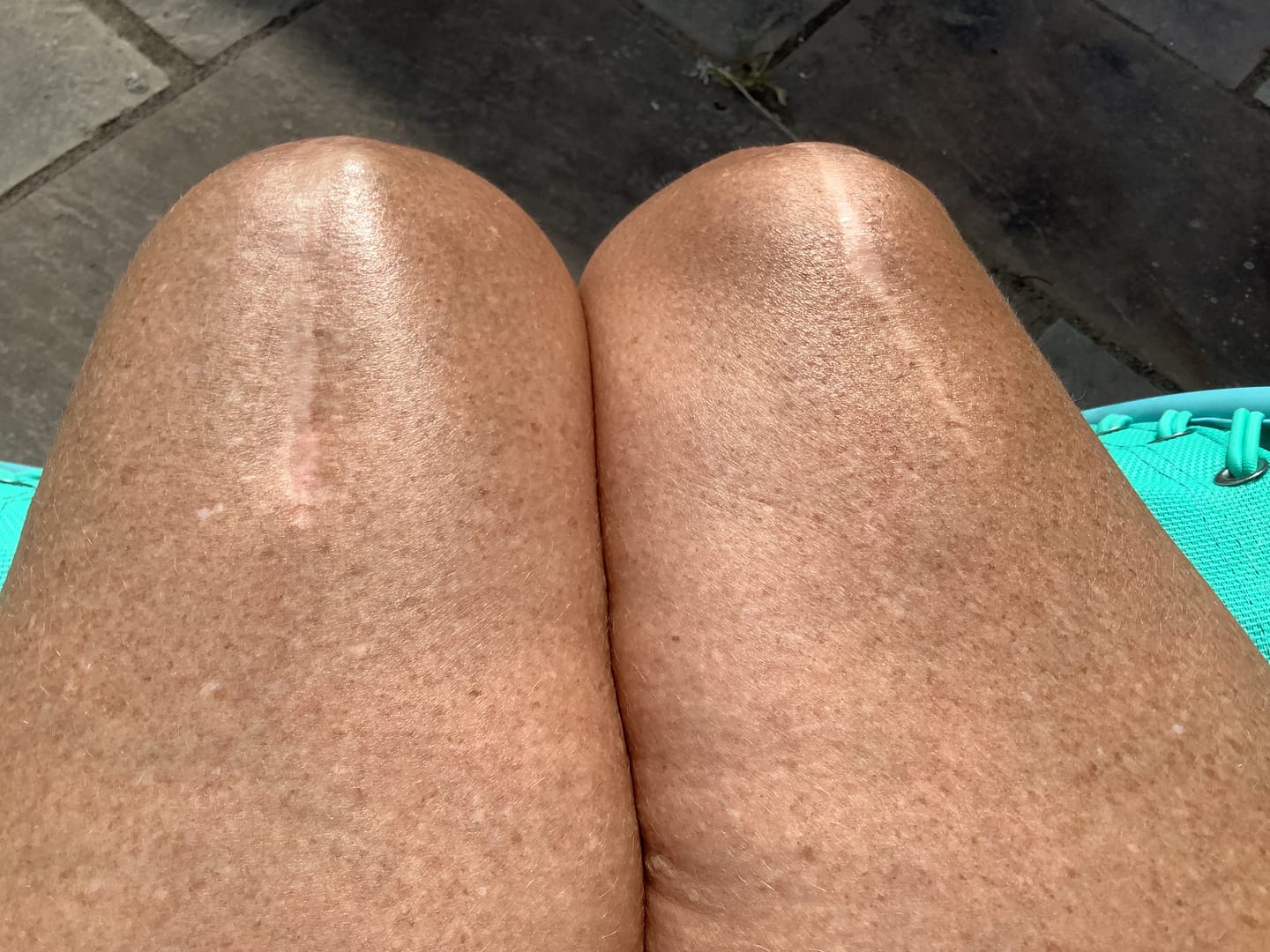 Customer photo review of Body For Us Anti-Cellulite Massage Oil
