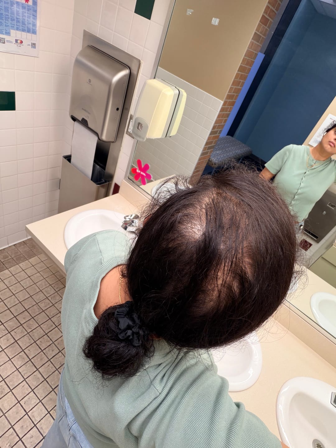 Customer photo review of VITAFOAM ™ Hair Growth Formula