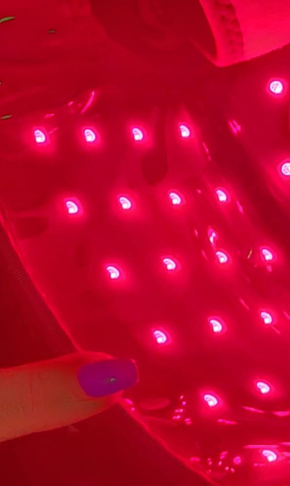 Customer photo review of REVIMUS MOTION™