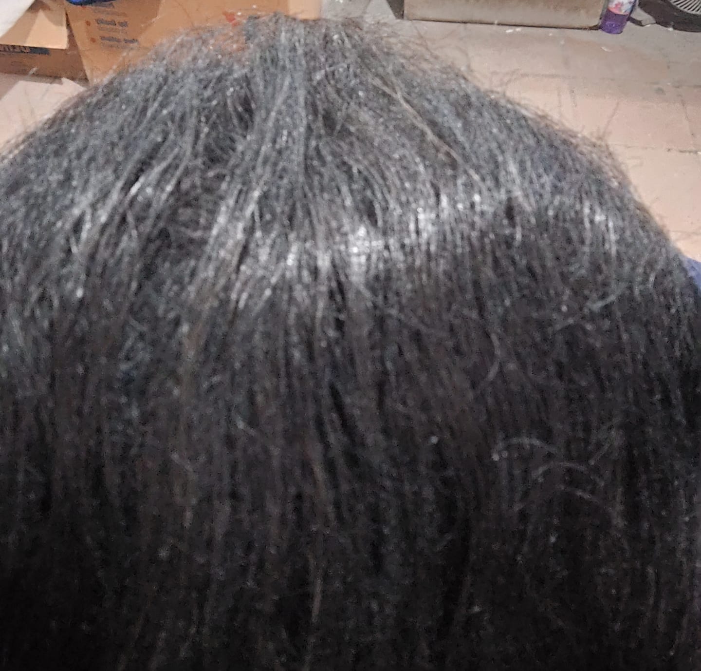 Customer photo review of SKALPURE – Crema Corrector Capilar 50ml | Cubre Calvicie y Entradas