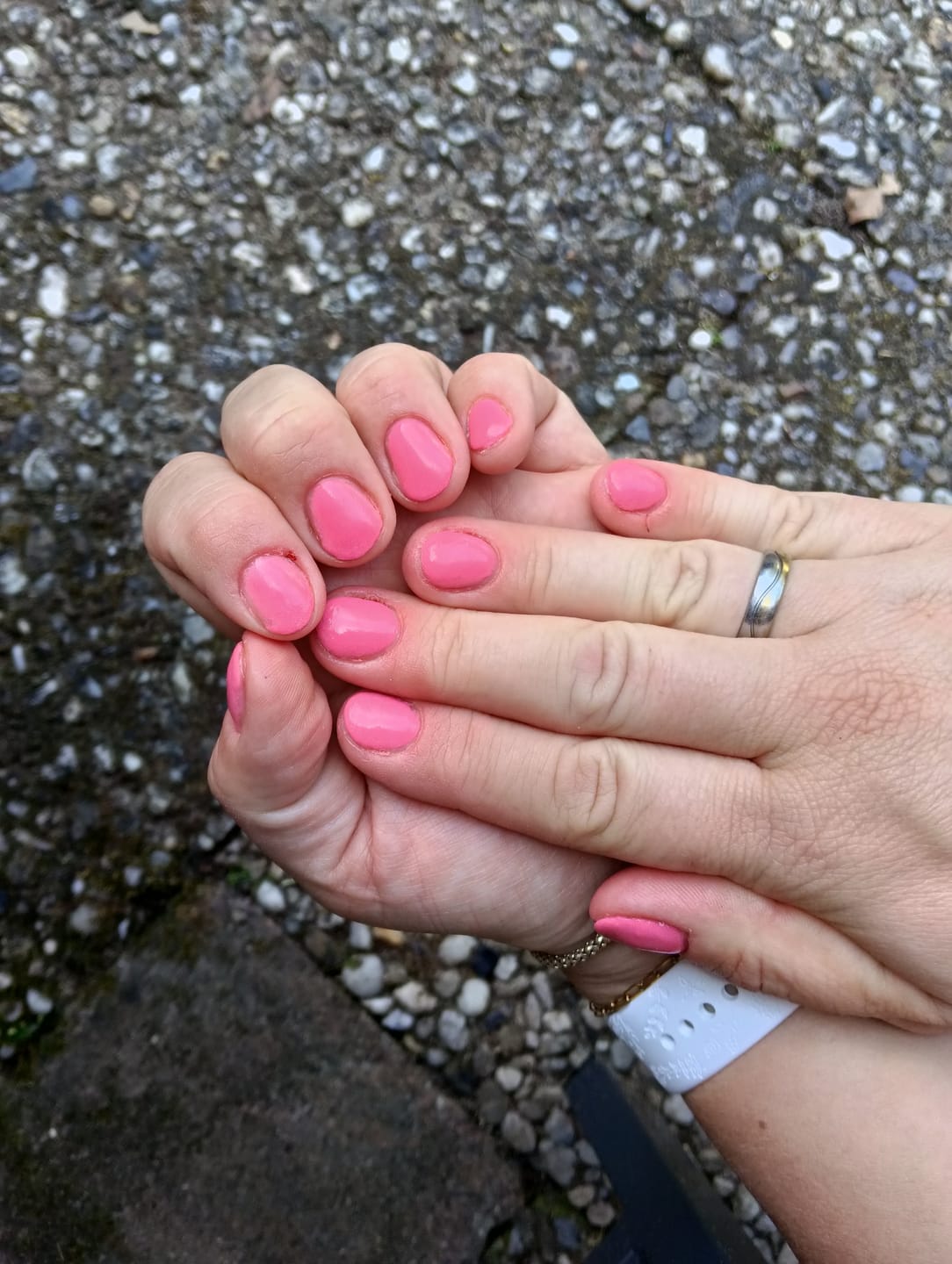 Customer photo review of Glowdip Alles-in-één Manicure Set