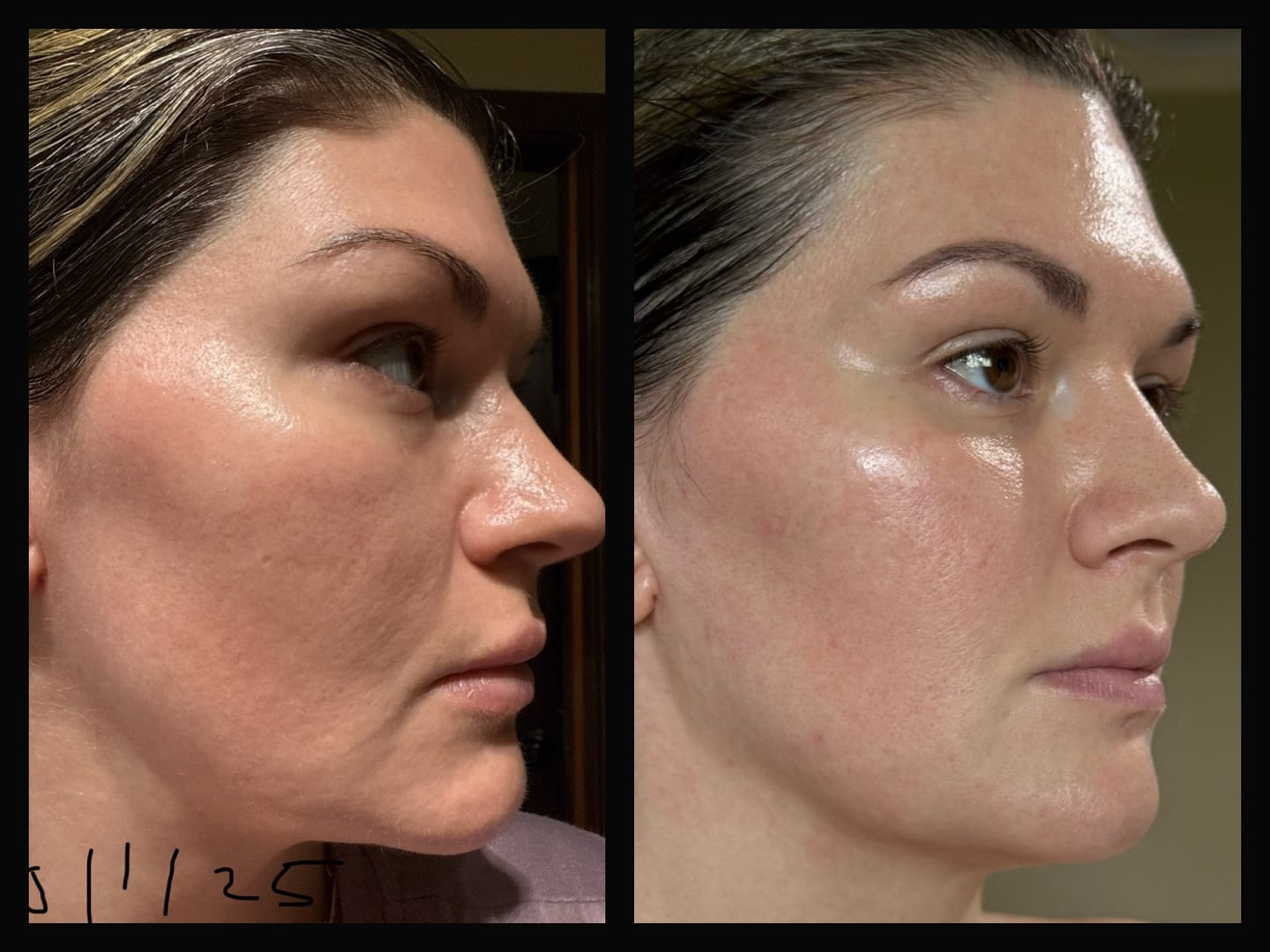 Customer photo review of VEAUTY Dot & Aqualis Activator