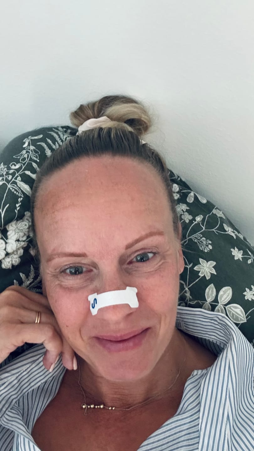 Customer photo review of Nuku Sleep Nasal Strips