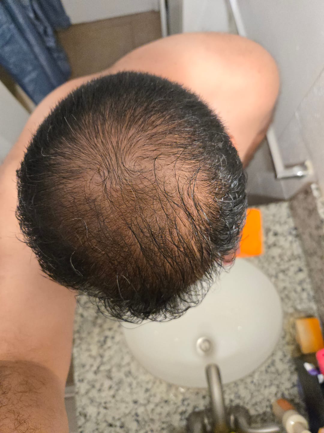 Customer photo review of SPARTAN™ - Root Activator Shampoo