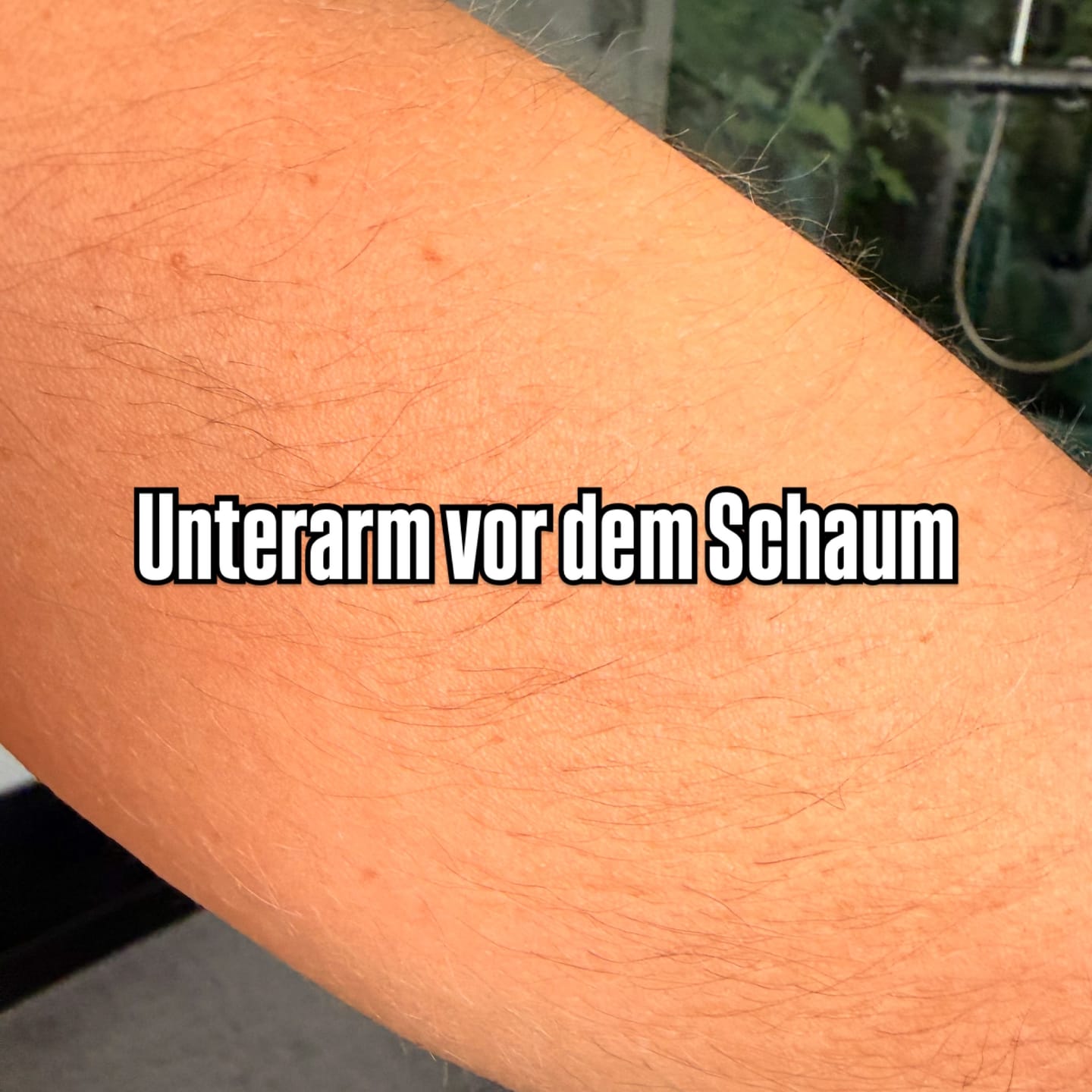 Customer photo review of Haarentfernungsschaum