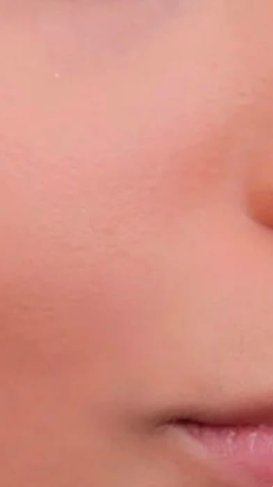 Customer photo review of Maxdif Brightening Serum