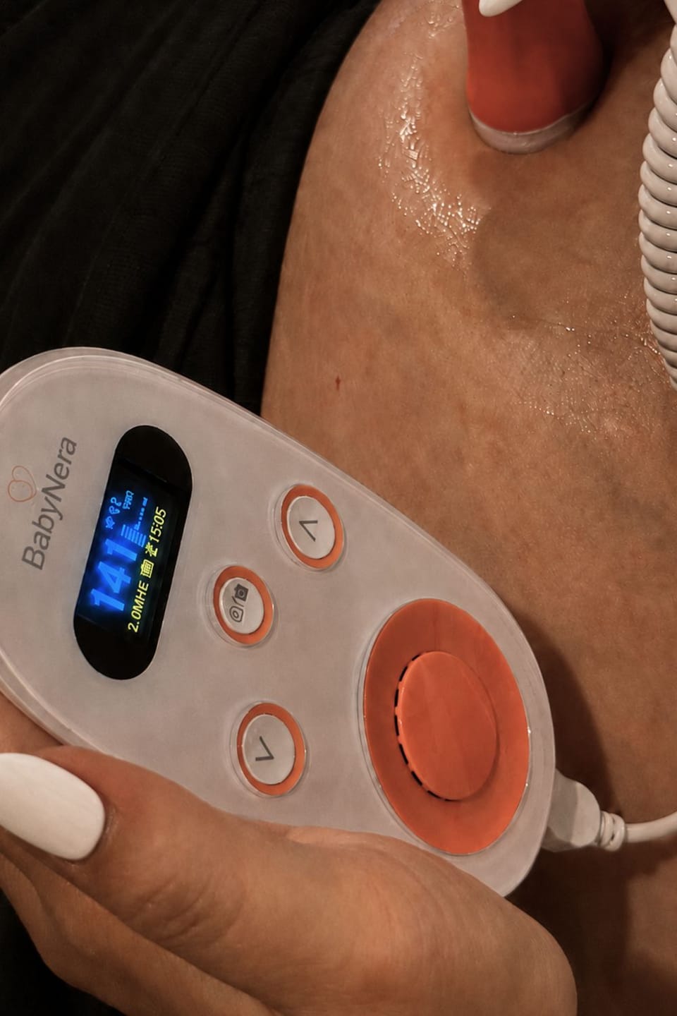 Customer photo review of BabyNera HeartEcho™ At-Home Fetal Doppler