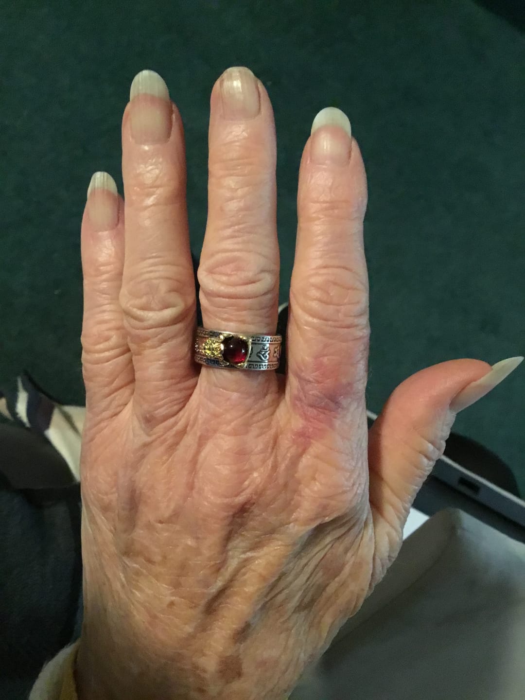 Customer photo review of Buddha Stones Red Agate PiXiu Wealth Ring
