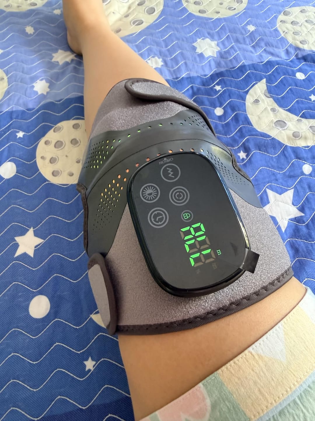 Customer photo review of REVIMUS MOTION™