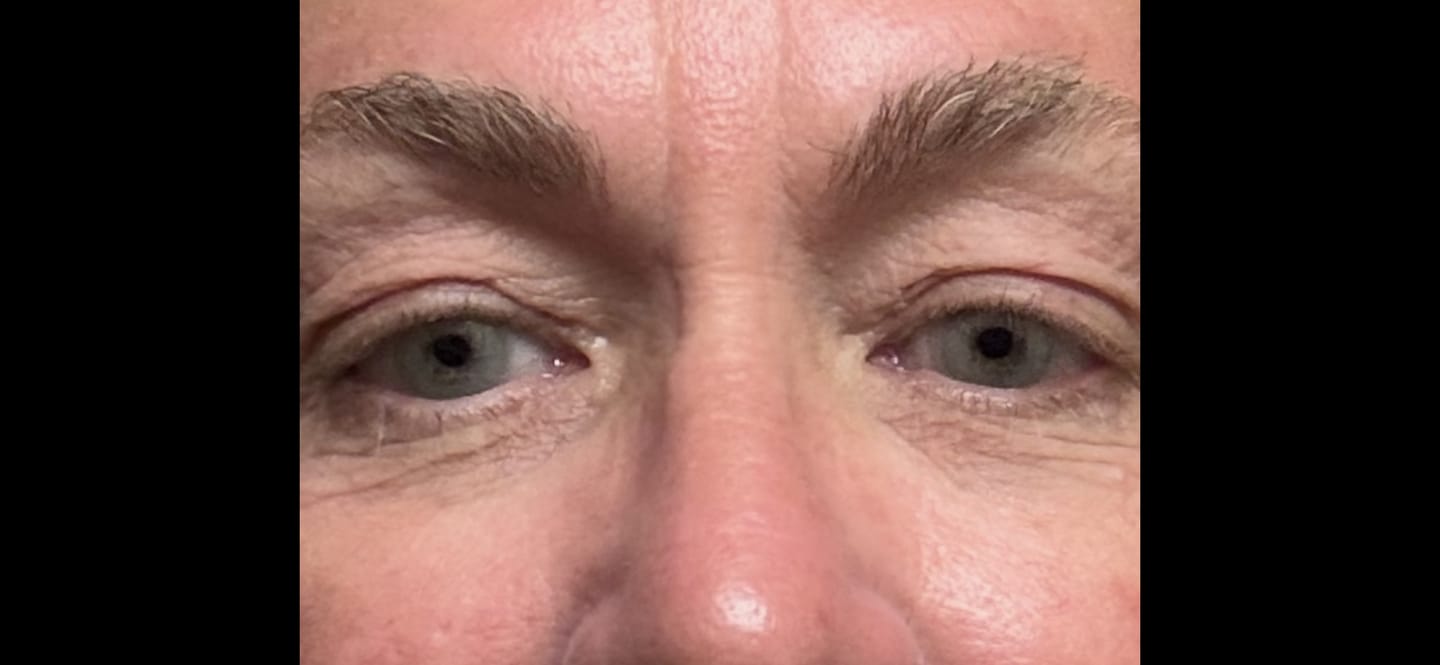 Customer photo review of Hidrocor Quartz Blue Gray Prescription Colored Contact Lenses