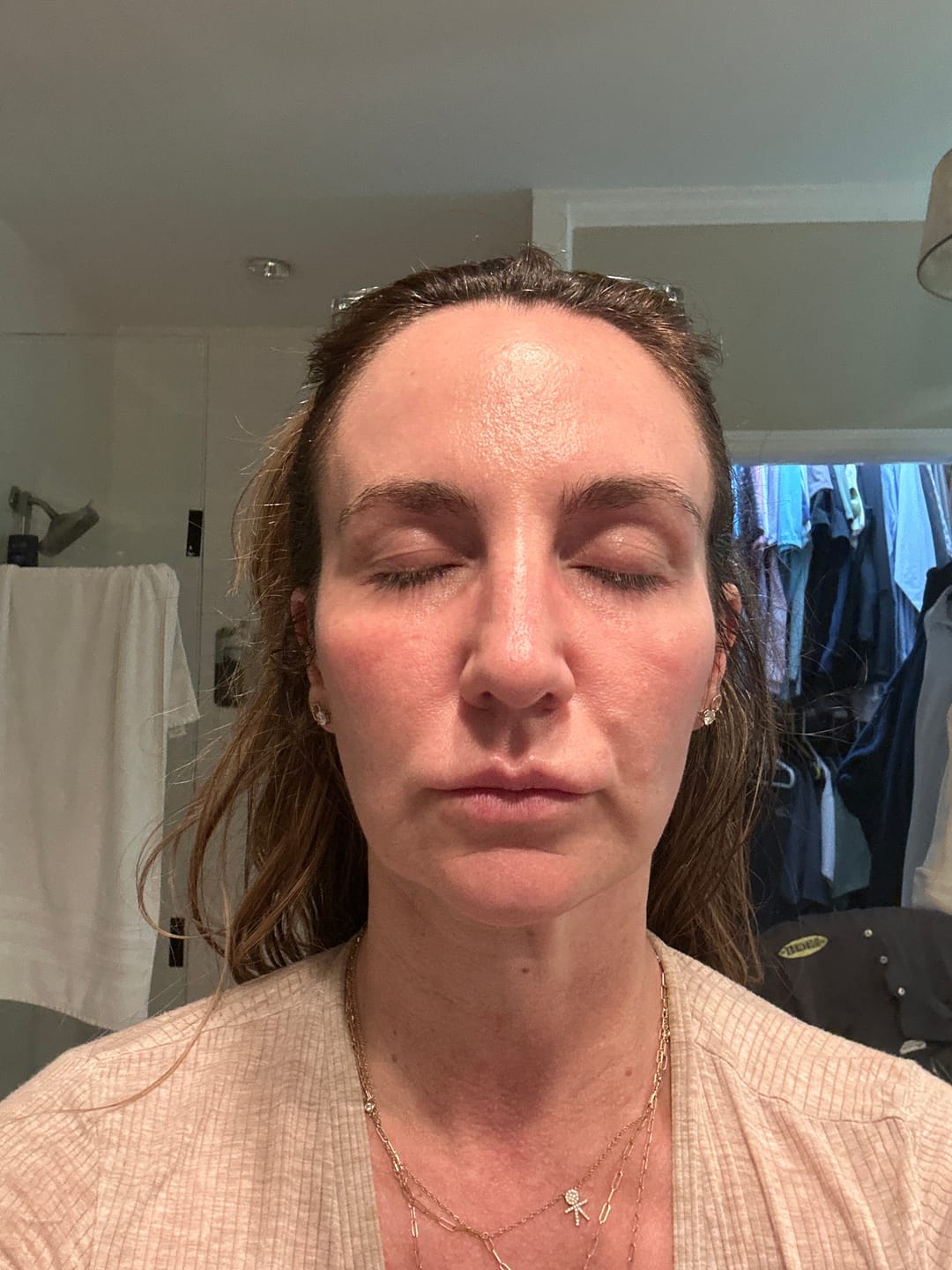 Customer photo review of PDRN & Peptide-8 Glass Skin Serum