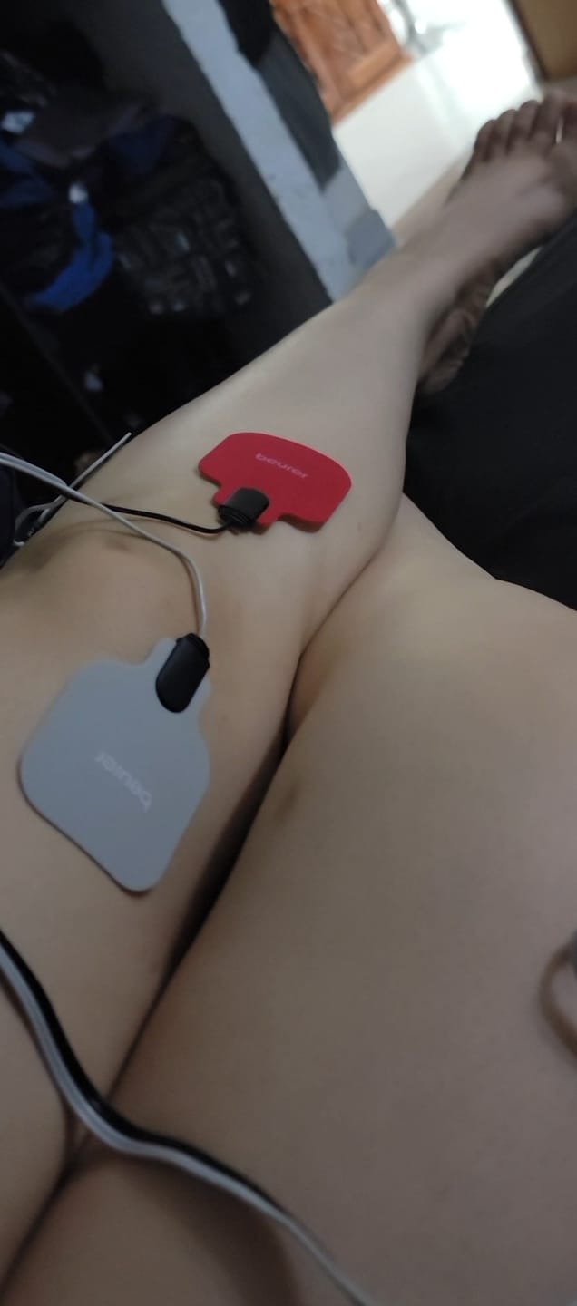 Customer photo review of Parches Electrodos para Electroestimulador EM41 Beurer | Set de 8 Electrodos Adhesivos para Fisioterapia y TENS