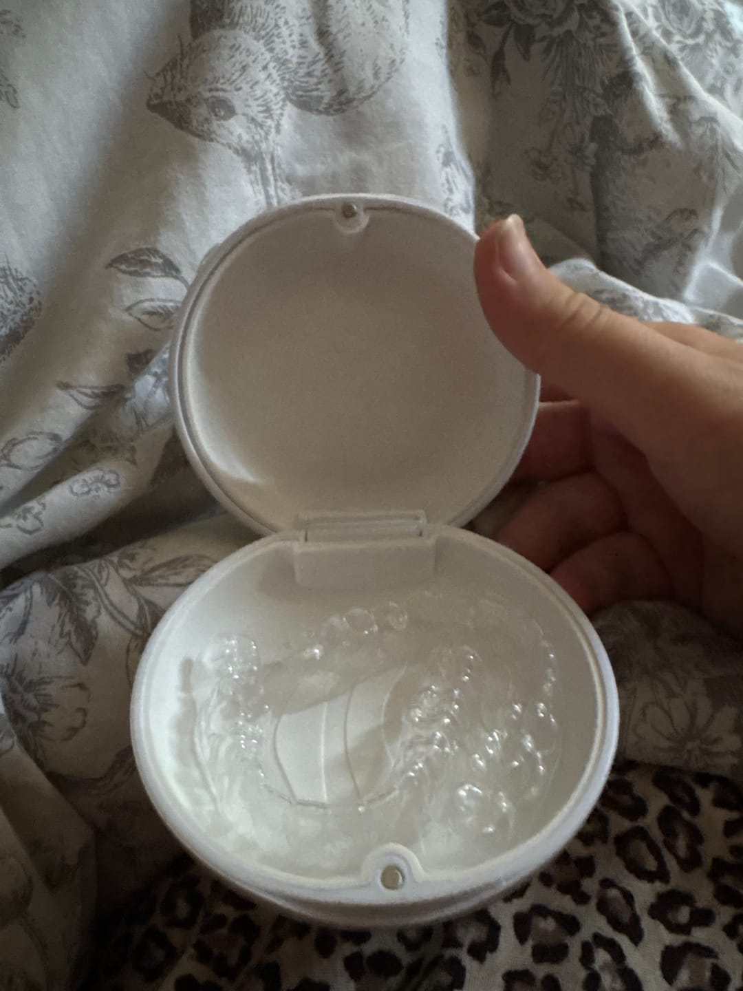 Customer photo review of Essix Retainers