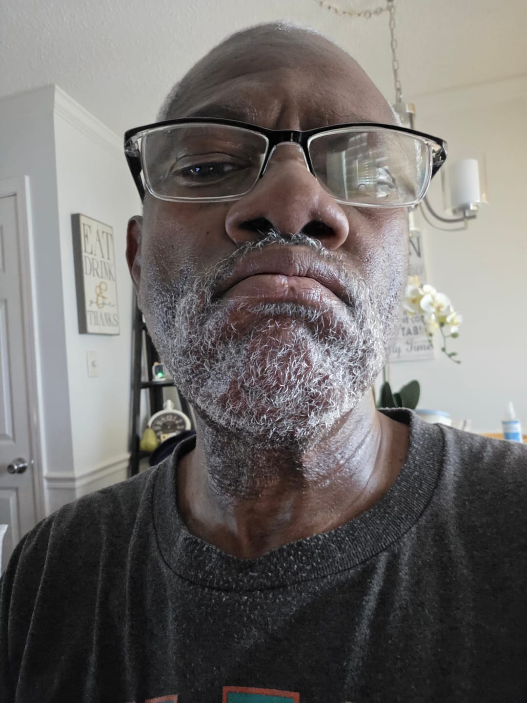 Customer photo review of Razor Bump Solution