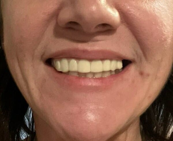 Customer photo review of DentLux™