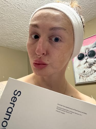 Customer's Seranova Micro Infusion System box, held by the reviewer with their face visible in the background