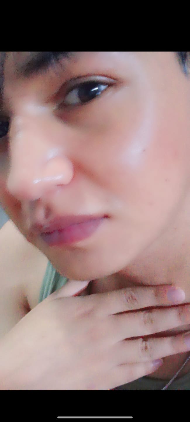 Customer photo review of MandelAC Serum