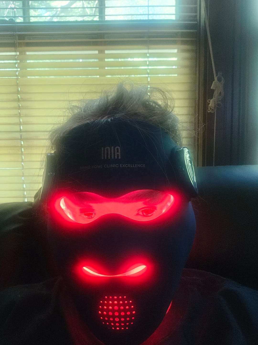 Customer photo review of INIA GLOW 4D 940nm Dual NIR Wireless LED Mask