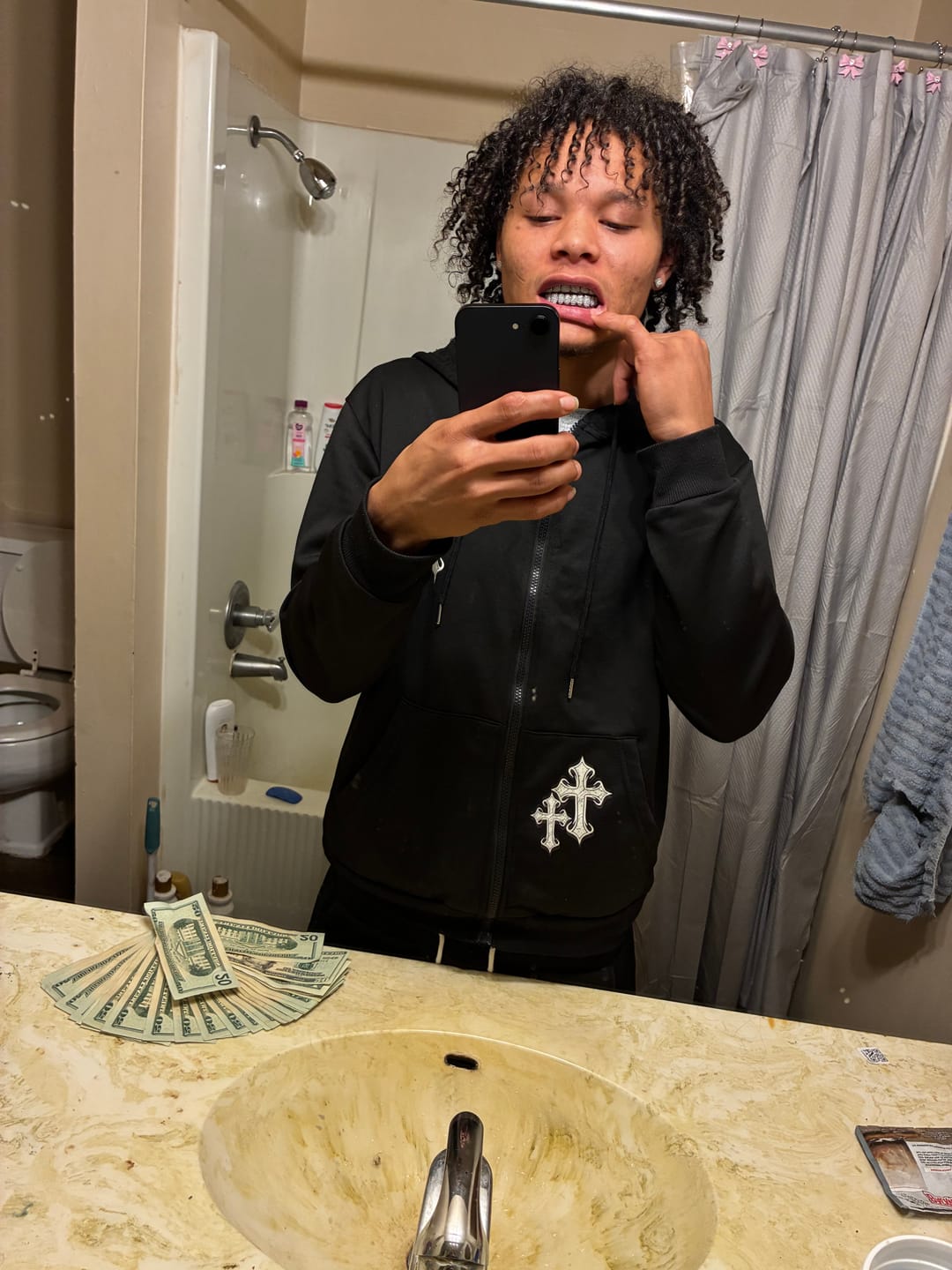 Customer photo review of 18k Gold Diamond Grillz