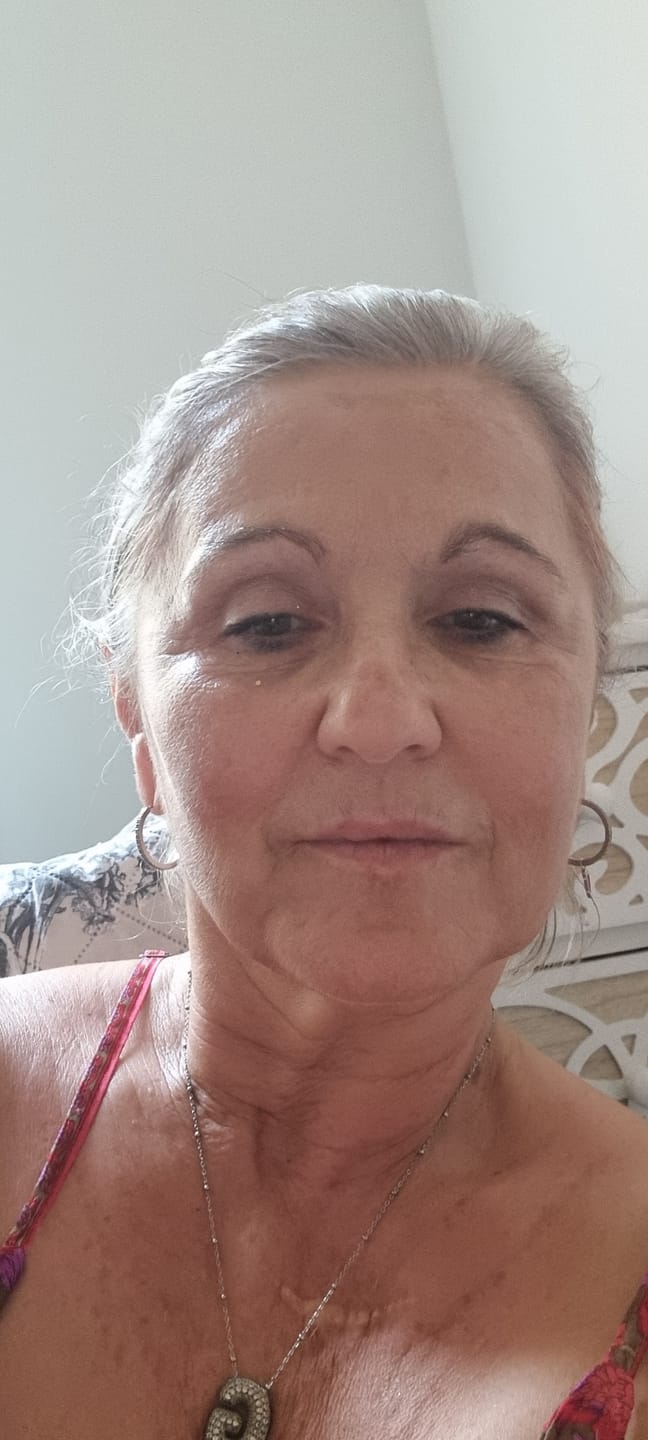 Customer photo review of BioChroma – Siero Coreano Effetto Lifting dalla Prima Applicazione