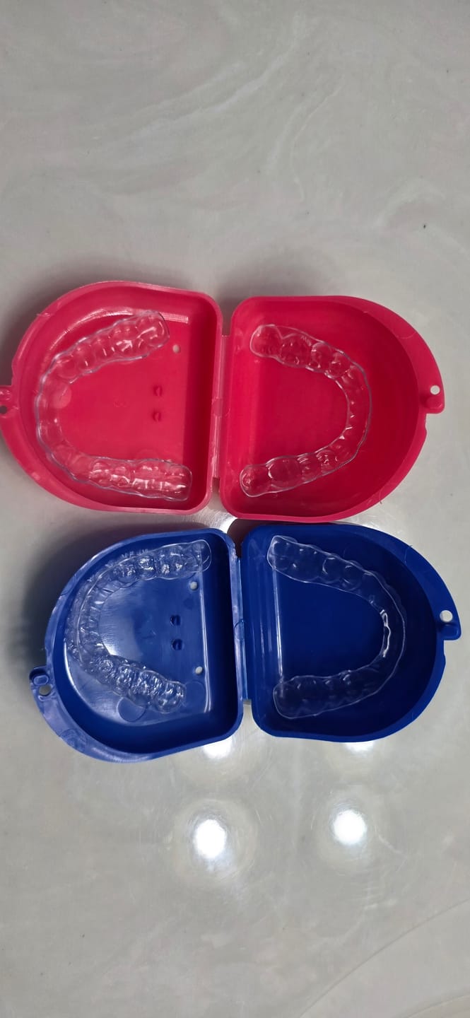 Customer photo review of Shipping Protection