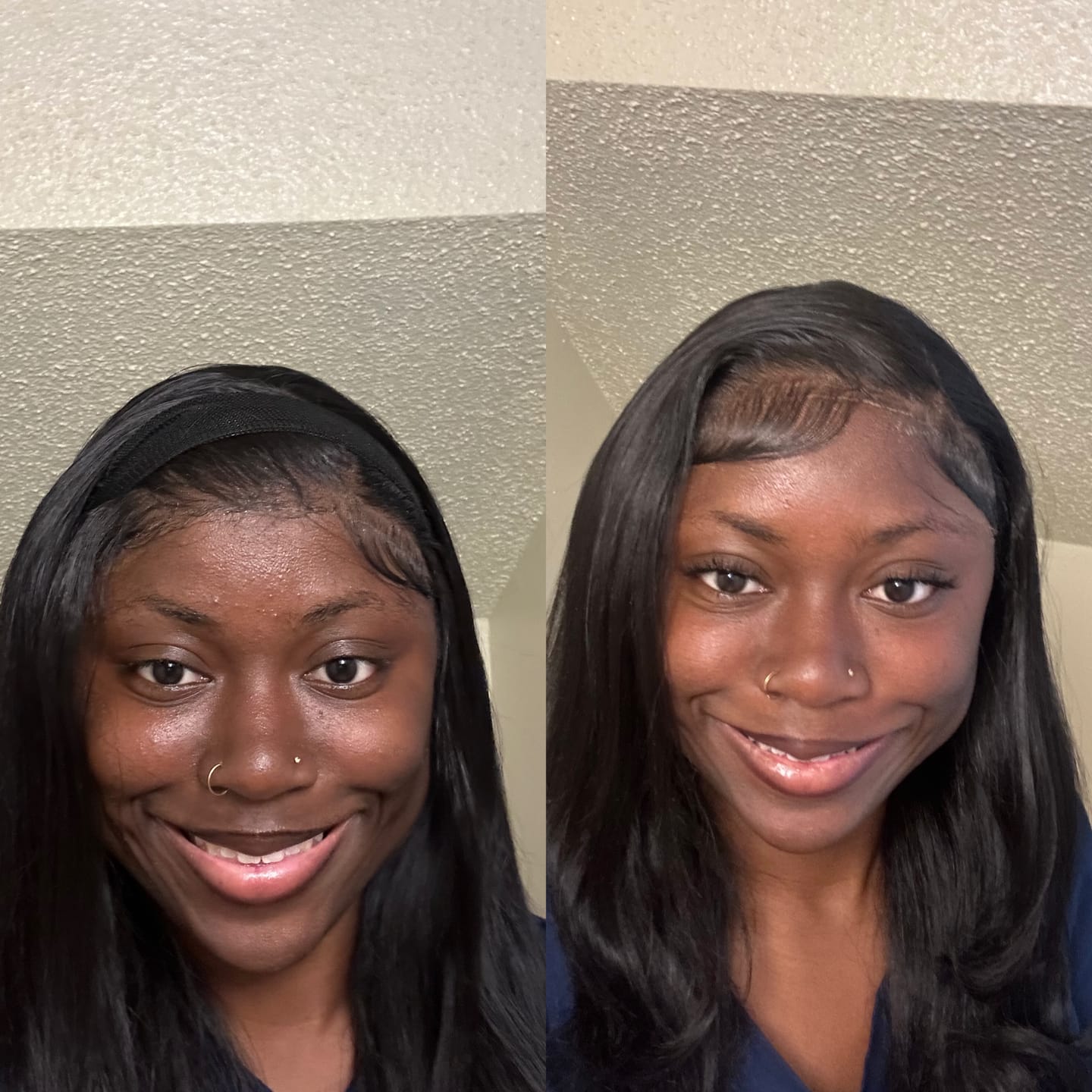 Customer photo review of Duo Skincare Bundle