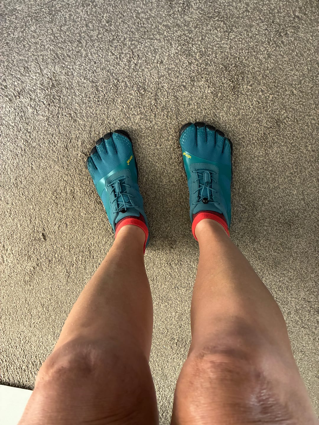 Customer photo review of Vibram No Show Toe Socks (2 Pack) Dark Grey/Red Black