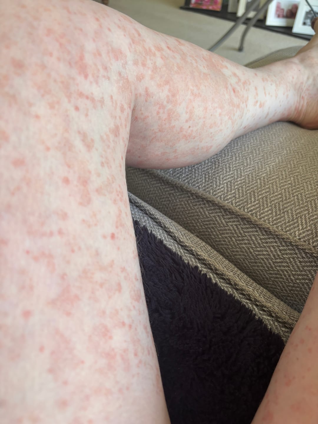 Customer photo review of Multi Strain Biotic