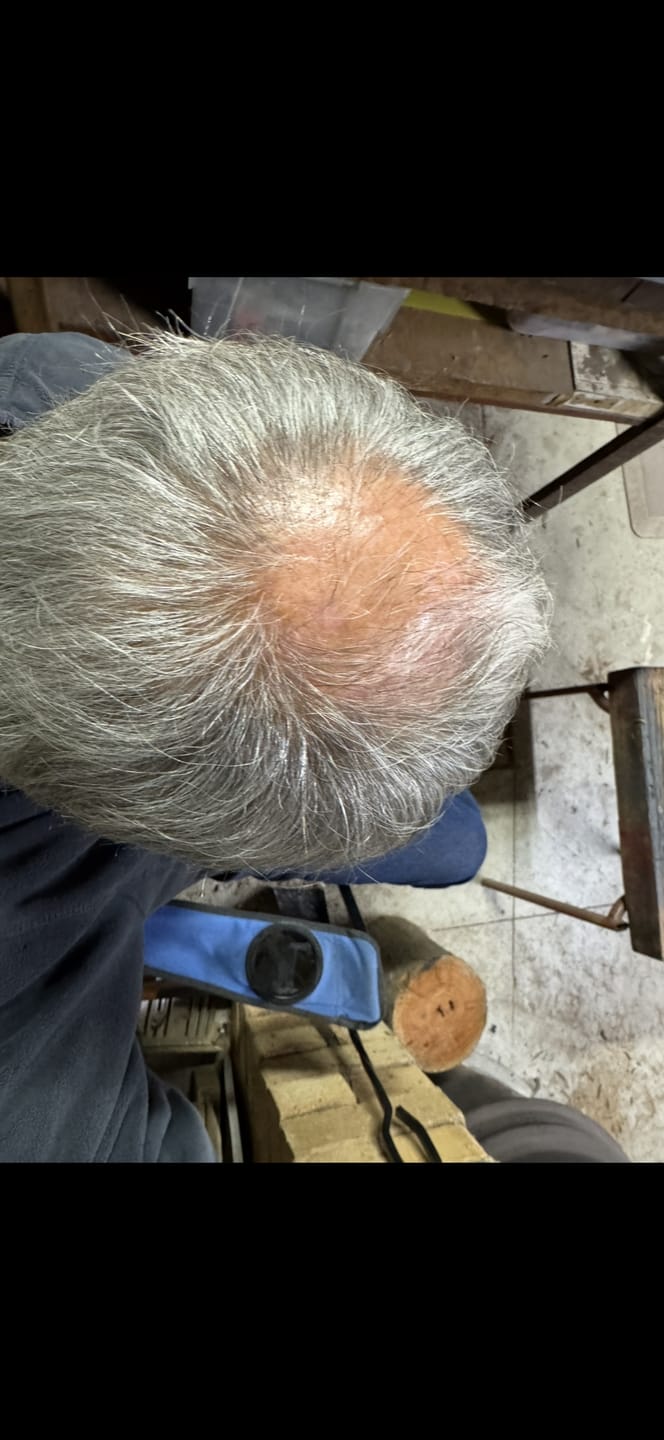 Customer photo review of Spartan™ Root Activator Shampoo 6 Bottles(sc)