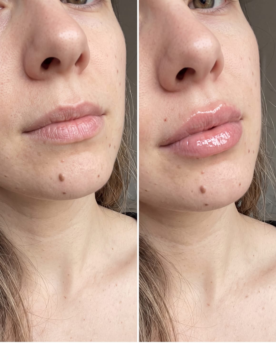 Customer photo review of Premium Korean Peptide Lip Plumper