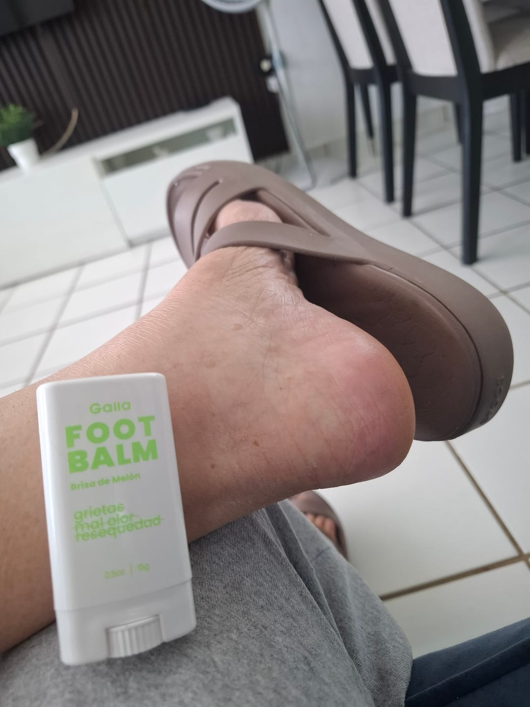 Customer photo review of Foot Balm