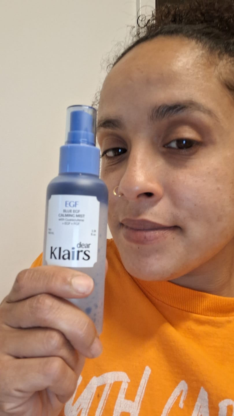 Customer photo review of Blue EGF Calming Mist