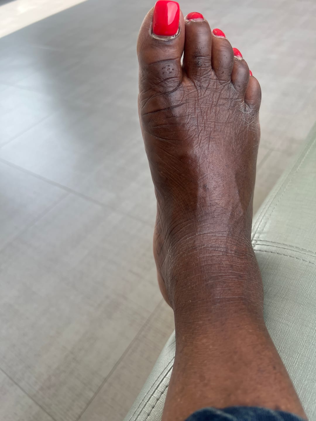 Customer photo review of Rapid Fading Dark Knuckle Treatment (Results Driven )