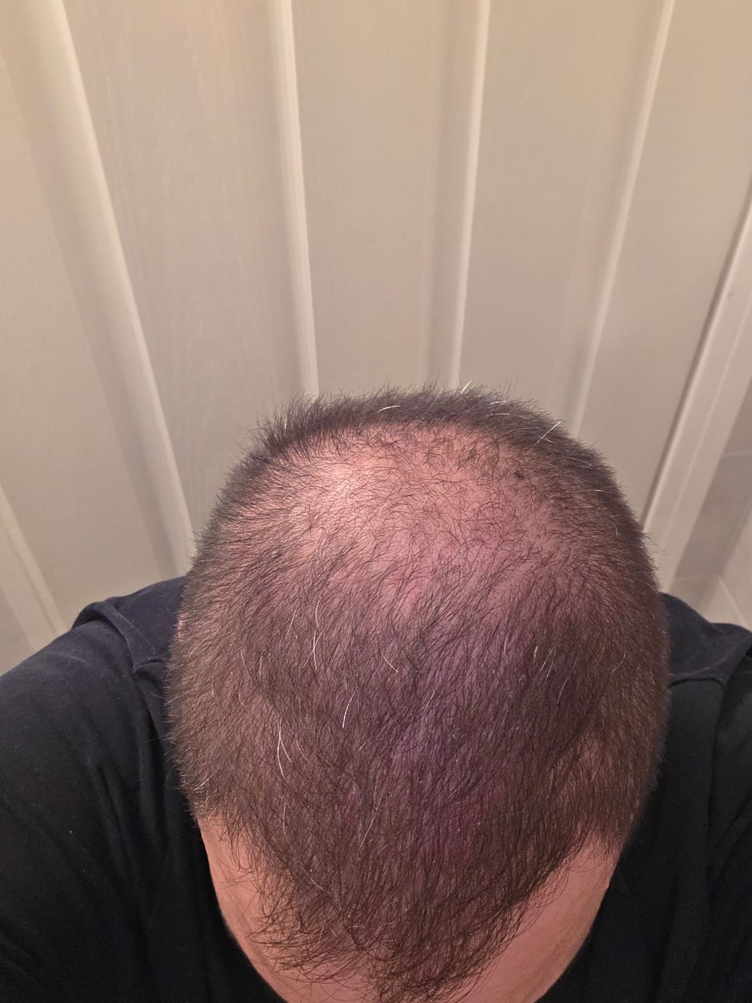 Customer photo review of Flxhair Saç tozu