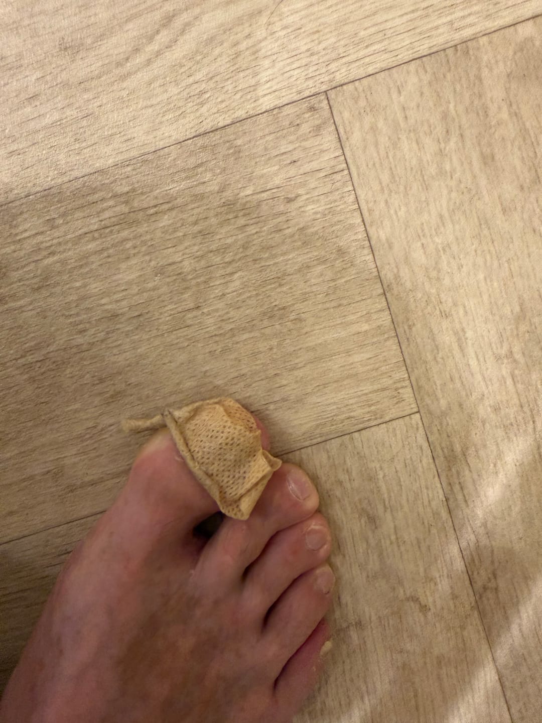 Customer photo review of VELCURA™ Fungal Nail Patches