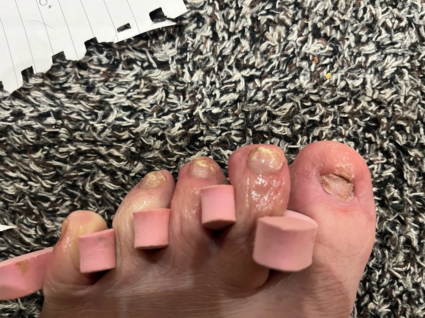 Customer photo review of Fungal Freedom