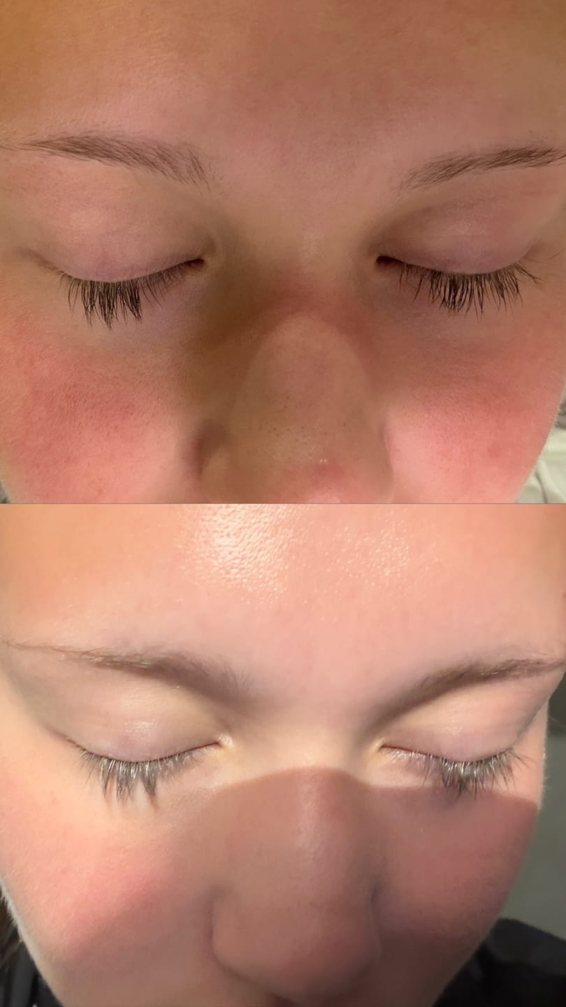 Customer photo review of Lash Serum | INTENSE
