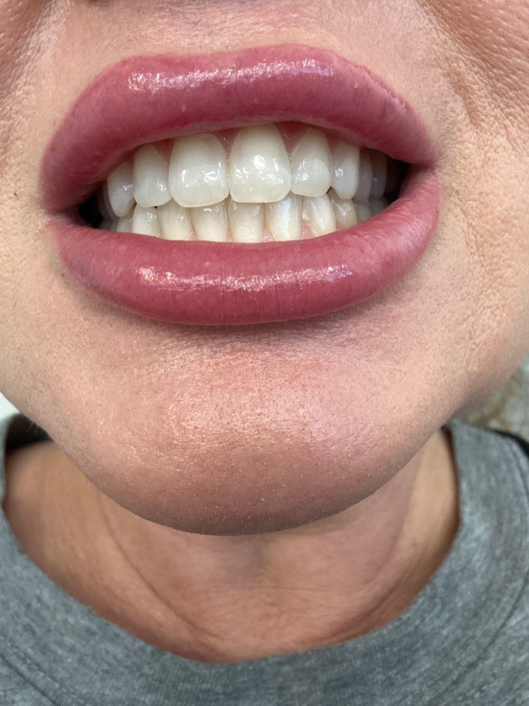 Customer photo review of LYSS zubná kefka - extra mäkká