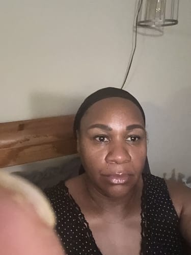 Customer photo review of Cemenrete Calcium Multi Balm 9g