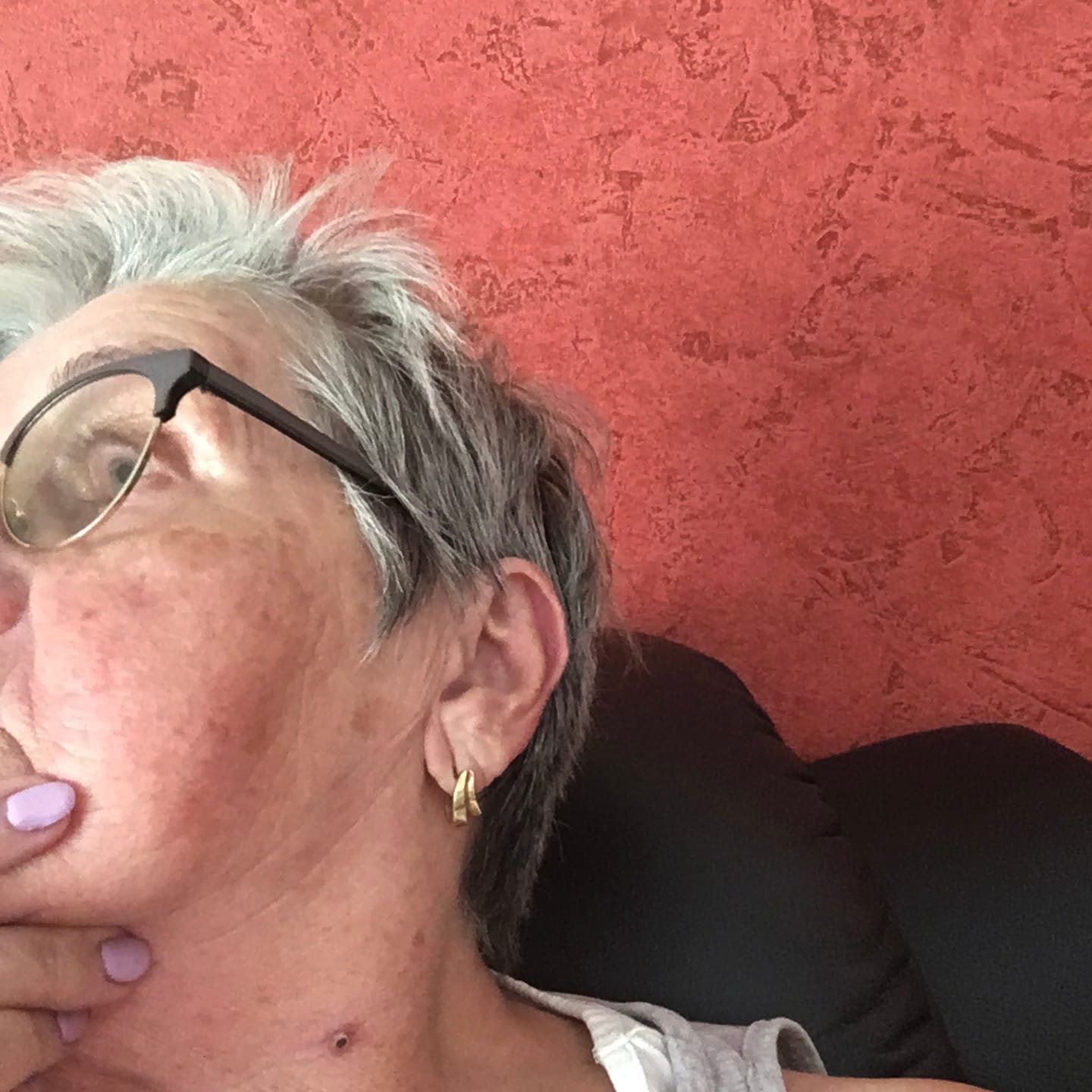 Customer photo review of Alcura Aftercare Patches
