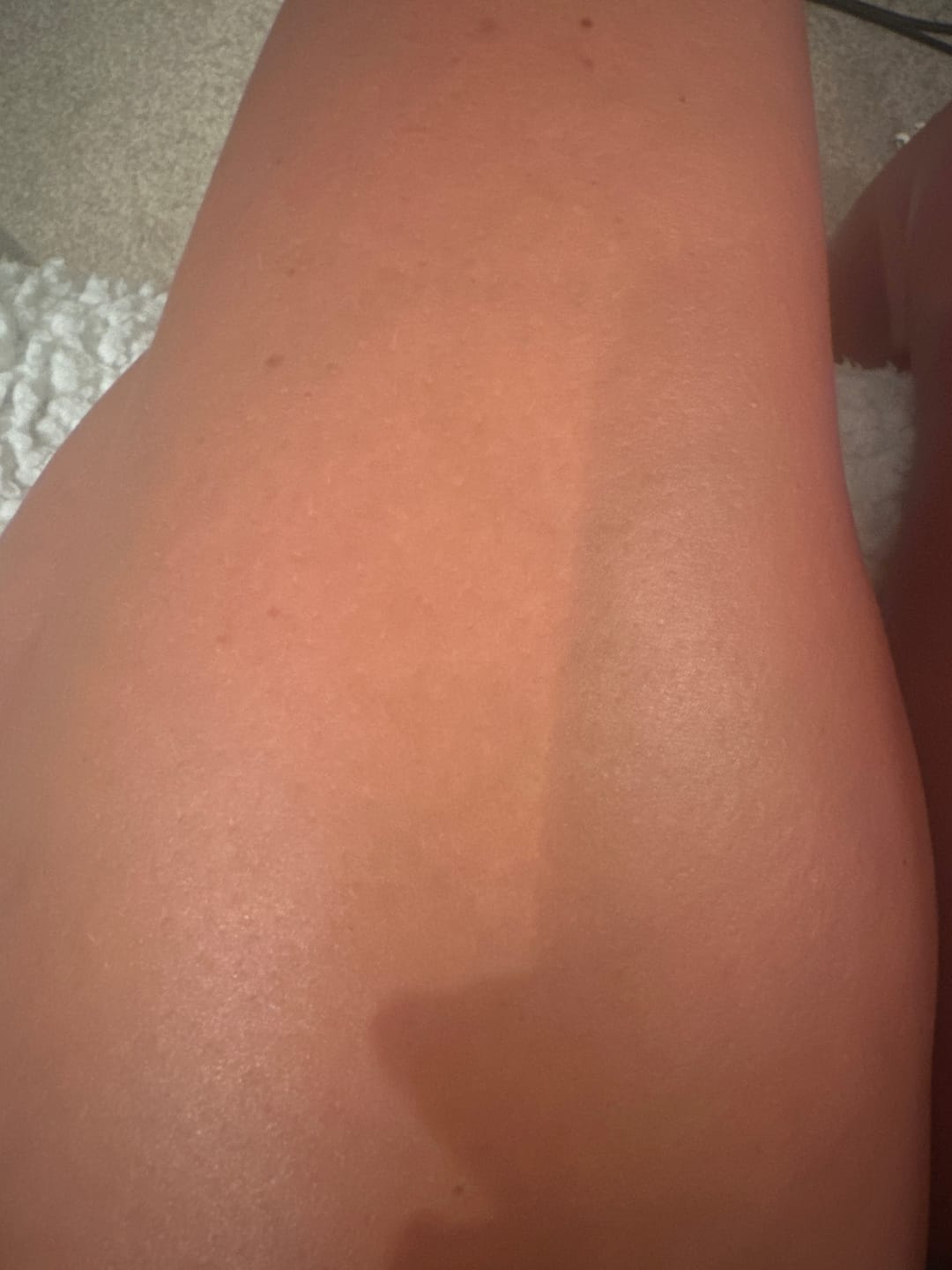 Customer photo review of NØRD BODY Anti-Cellulite Massage Oil