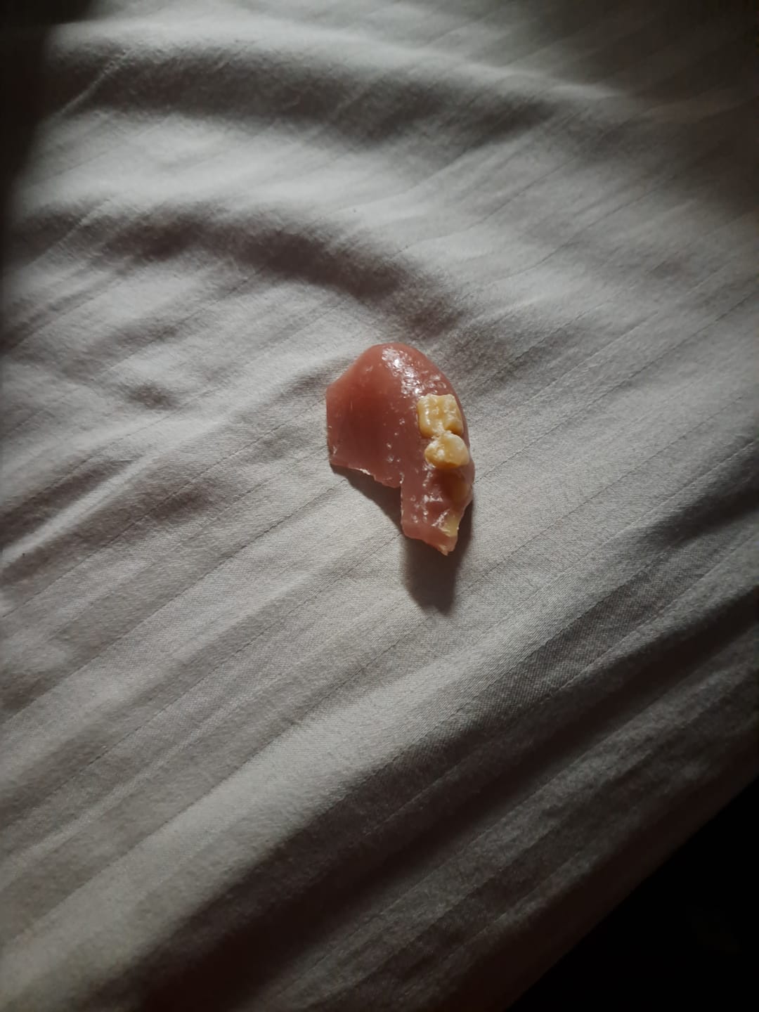 Customer photo review of Easy Denture