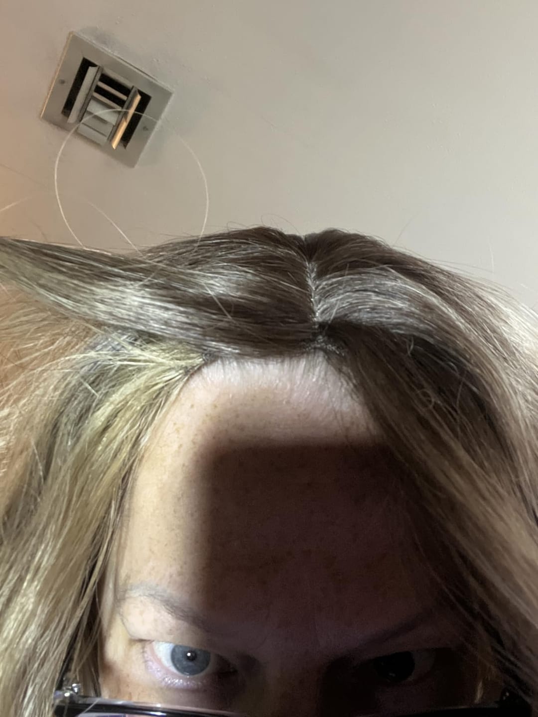 Customer photo review of Topper Hair Pieces For Hair Loss Ombre Brown to Blonde #T10/613-3*5 inch |Youngsee