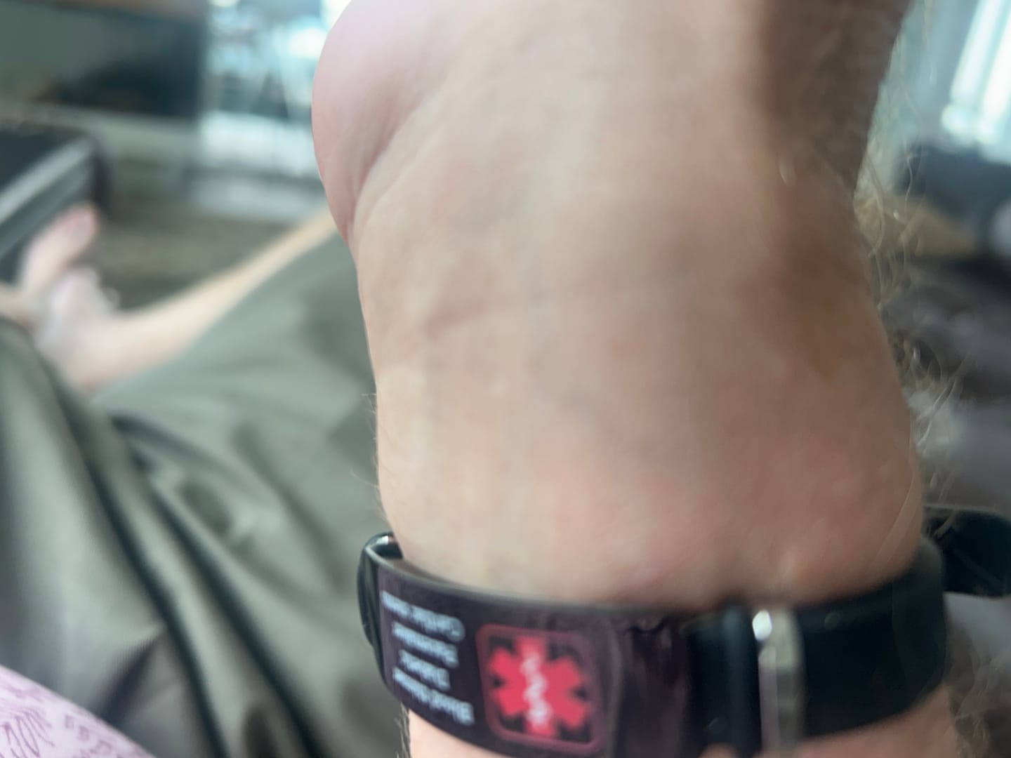 Customer photo review of Medical Alert Bracelet
