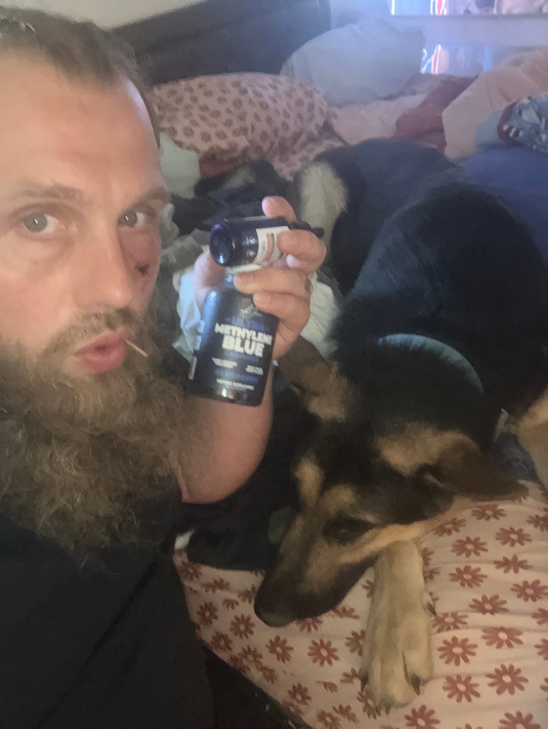 Customer photo review of Ultra Methylene Blue Gummies (60 Gummies)
