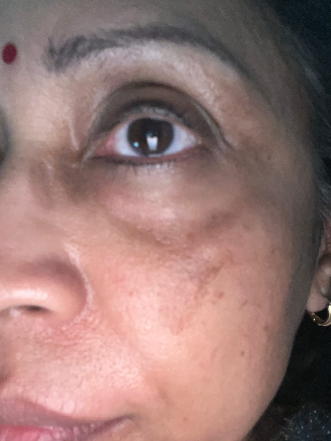 Customer photo review of 🎁 Instant Pore Eraser (1.5ml) (100% off)
