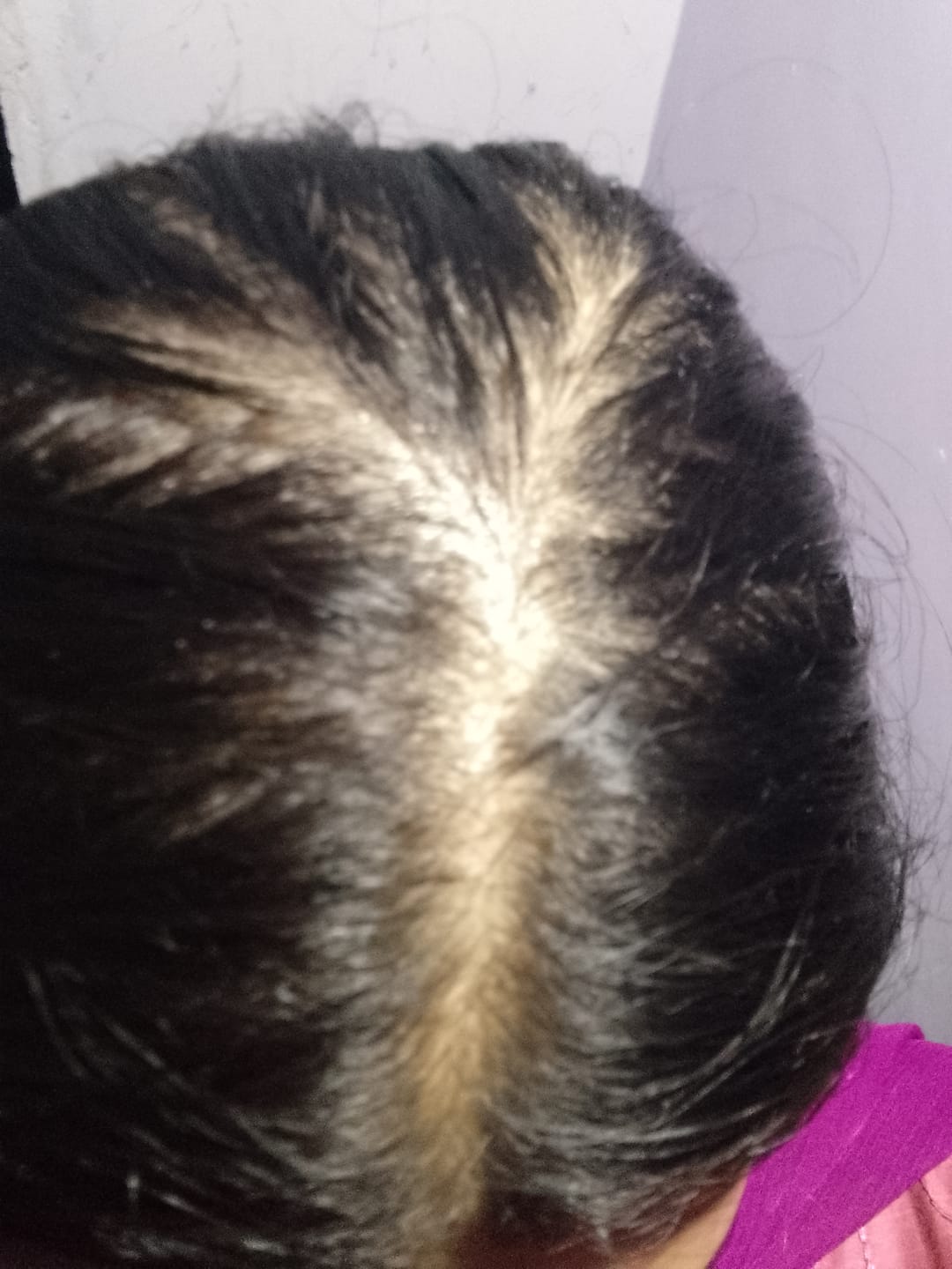 Customer photo review of Anagrow Hair Serum
