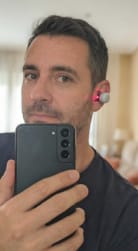 Customer photo review of AURALIS™ - Red light therapy